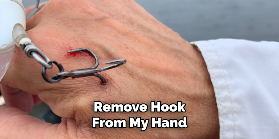 Remove Hook
From My Hand